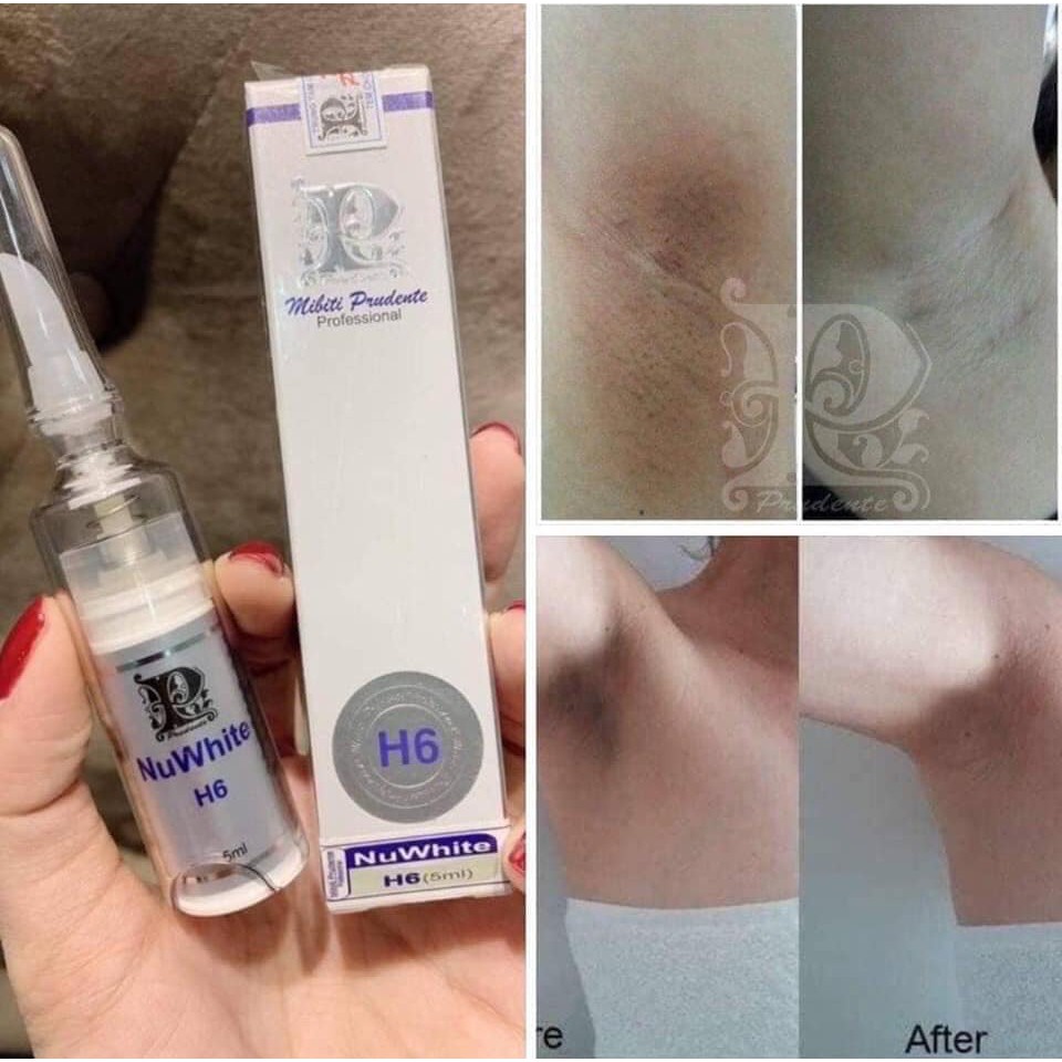 Kem Thâm Mông, Nách, Bẹn Nuwhite H6 5ml, Kem Làm Hồng H6 Alphawhite Mibiti Prudente Tăng Cường Sản Sinh Collagen