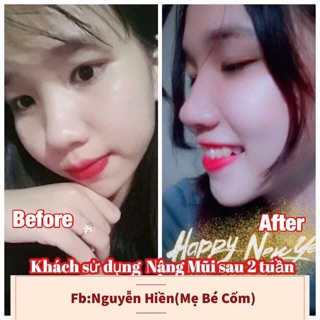 Serum Nâng Mũi Hàn