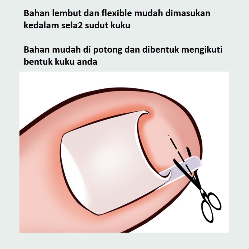 Đệm Silicone cách ly chống tràn cho móng tay