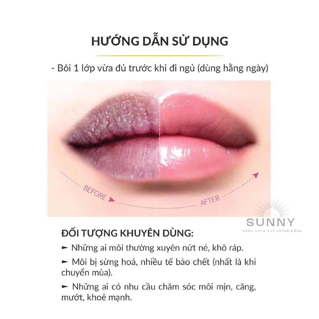 Serum dưỡng ẩm cho môi RNW Lip Treatment nội địa Hàn Quốc