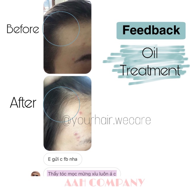 Dầu ủ OIL TREATMENT - |TẶNG Kem ủ + Mũ Trùm | | BigBuy360 - bigbuy360.vn