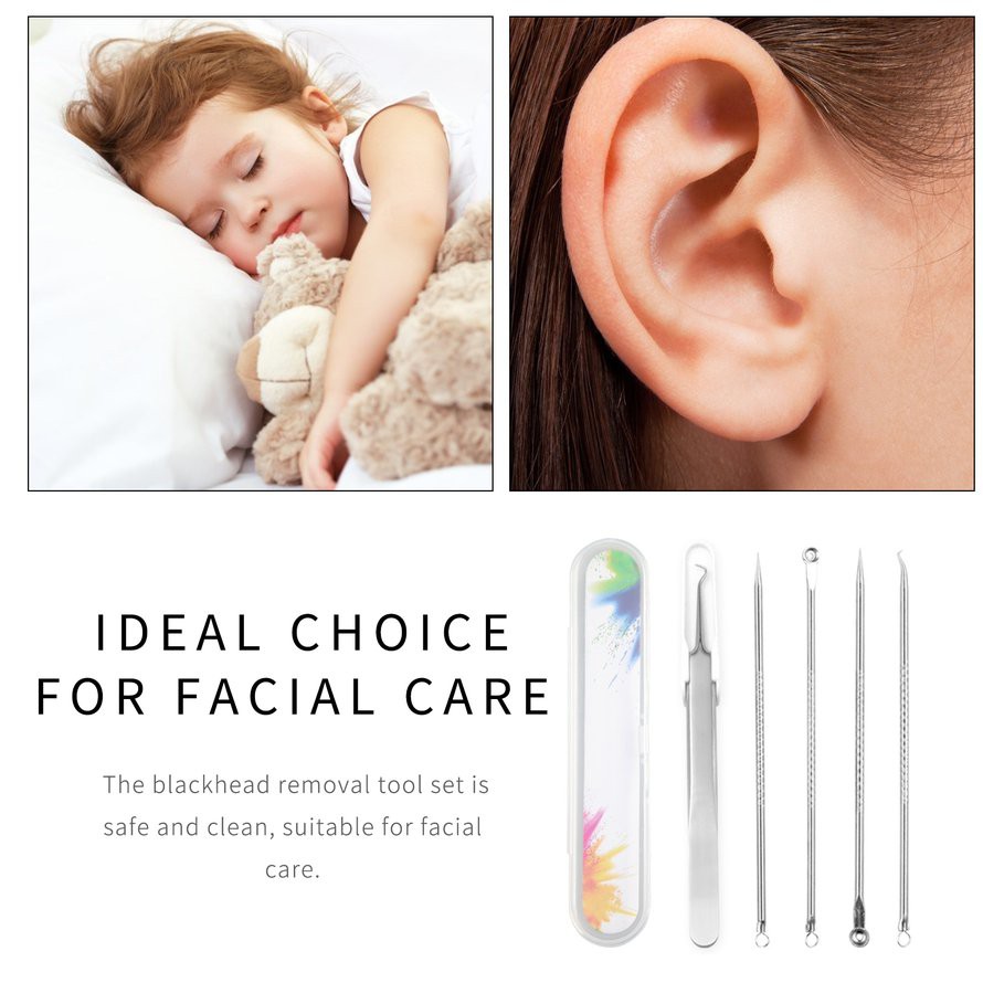 (Hàng Mới Về) Set 5 Dụng Cụ Nặn Mụn Đầu Đen Bằng Thép Không Gỉ