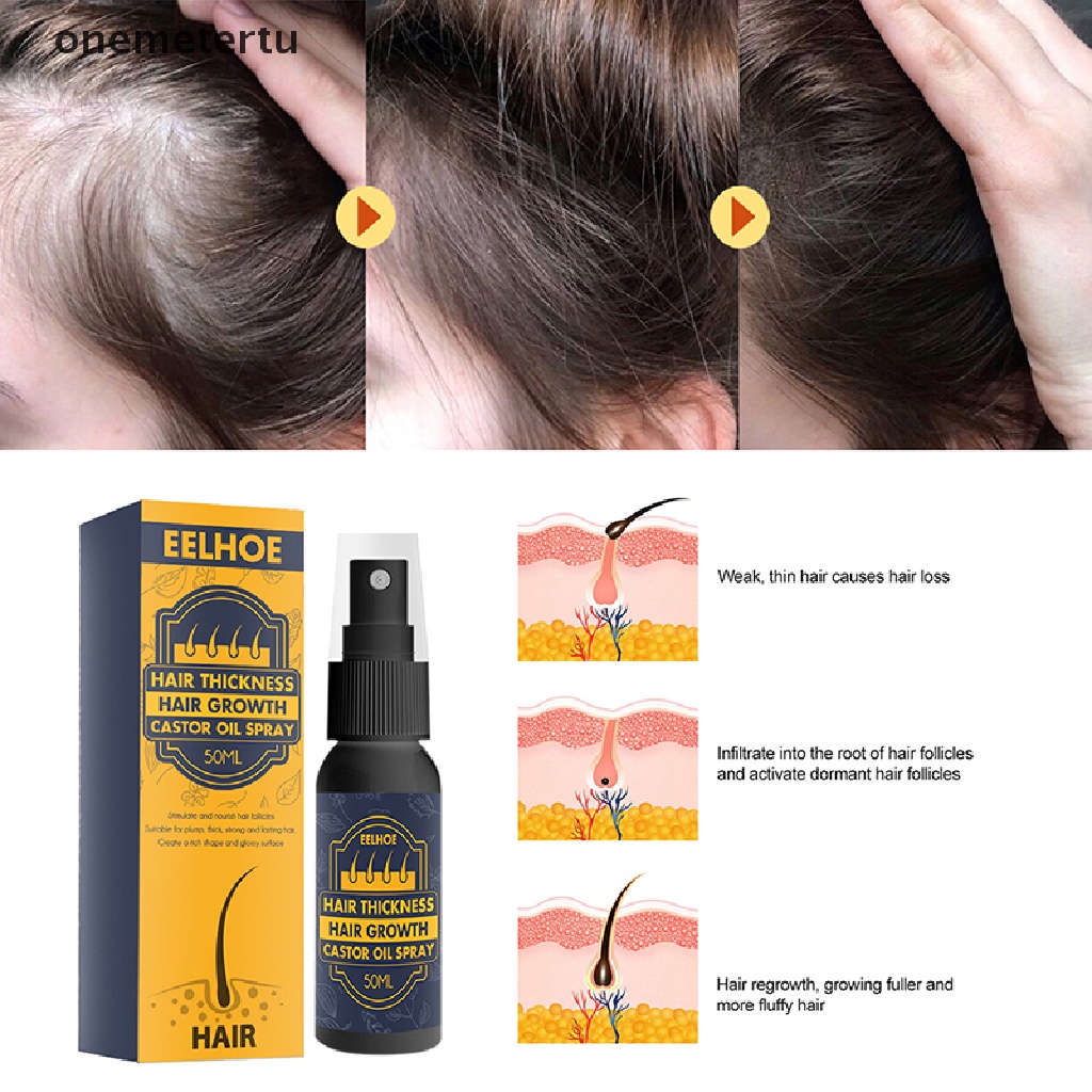 Tinh Dầu Thầu Dầu Kích Thích Mọc Tóc Chống Rụng Tóc onemetertu 50ml