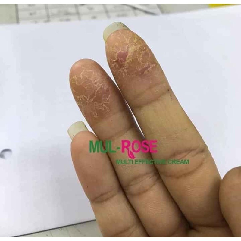 CÔNG DỤNG CỦA KEM MULL ROSE - Dưỡng da, làm sáng da, giúp da mềm mượt