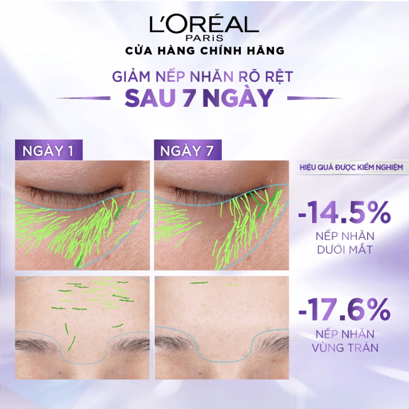 Bộ Serum & Kem dưỡng & kem chống nắng siêu cấp ẩm và giảm nếp nhăn L'Oreal Paris Hyaluronic Acid 1.0%