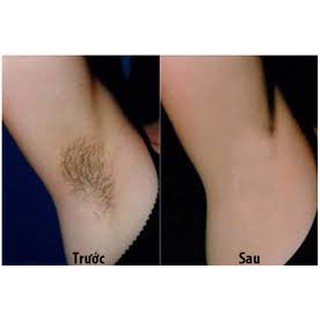 Kem Wax Lông Veo Wax Lông Triệt Để