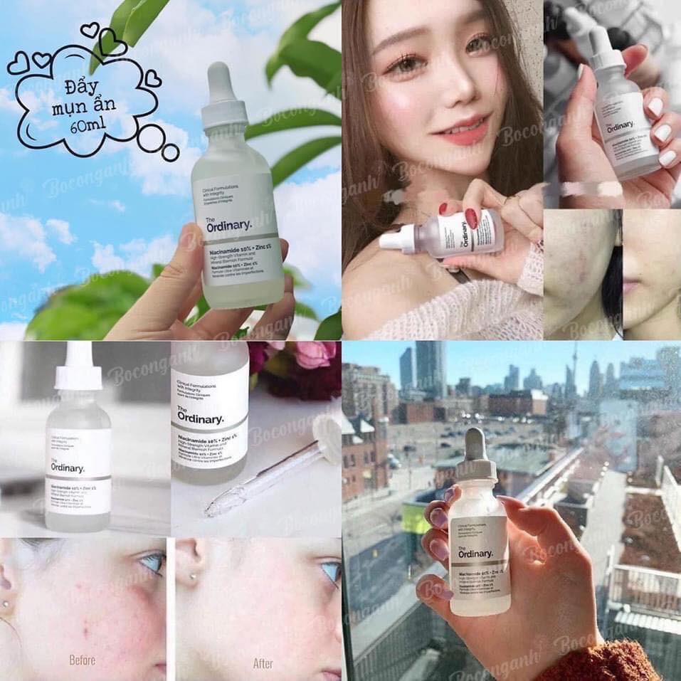 SERUM THE ORDINARY NIACINAMIDE 10% + ZINC 30ML