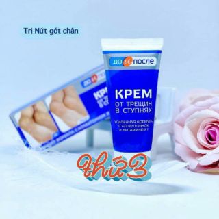 Kem trị nứt gót chân Nga Kpem