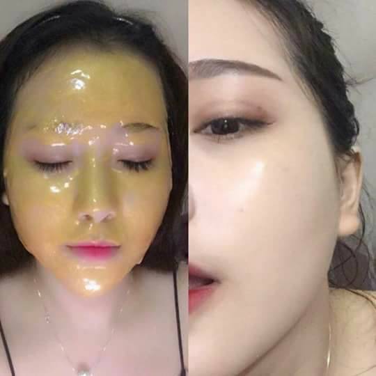 Mặt Nạ Collagen Tươi Vàng 24k Handmade - Thẩm Mỹ Huyền Trang NANOCEE