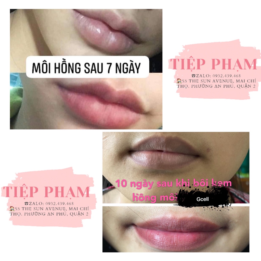 Kem Dưỡng Khử Thâm - Hồng Môi Xxvirgin L 5ml