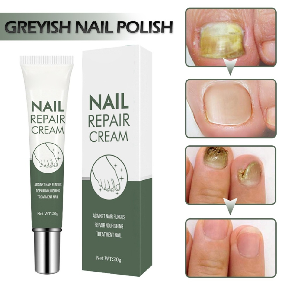 [Hàng mới về] Kem dưỡng phục hồi móng bị hư hỏng mất màu dành cho chăm sóc móng chân 20g