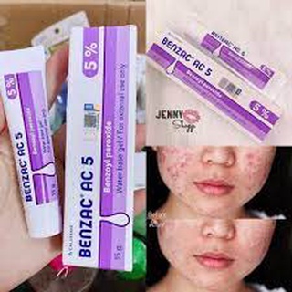 Benzac 5% chấm mụn viêm 15gam