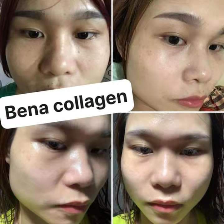 Bena collagen chính hãng giúp da trắng sáng căng bóng mịn màng