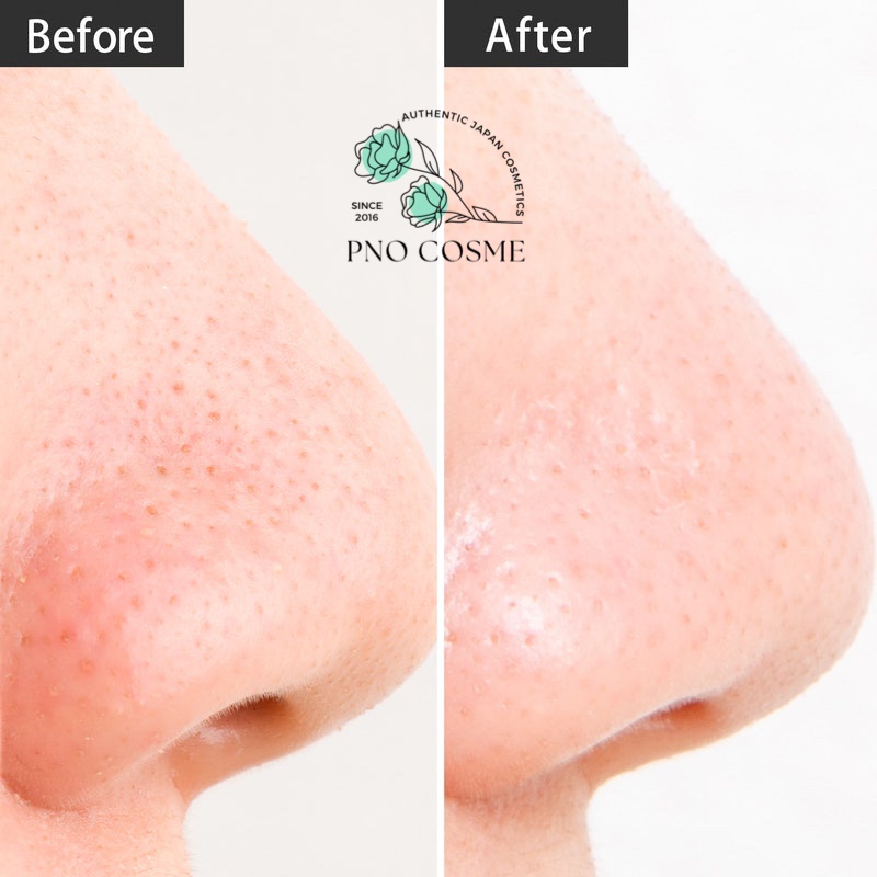 Sữa rửa mặt bọt dẻo Mocchi Skin