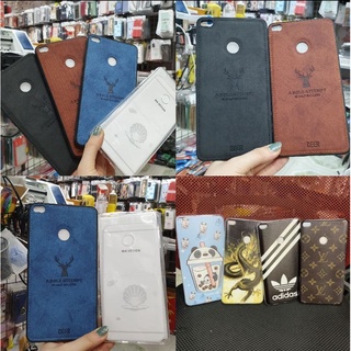 Ốp lưng Xiaomi Mi max 2 dẻo trong in hình kute