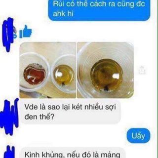 NƯỚC SÚC MIỆNG THẦN THÁNH PROPOLINSE