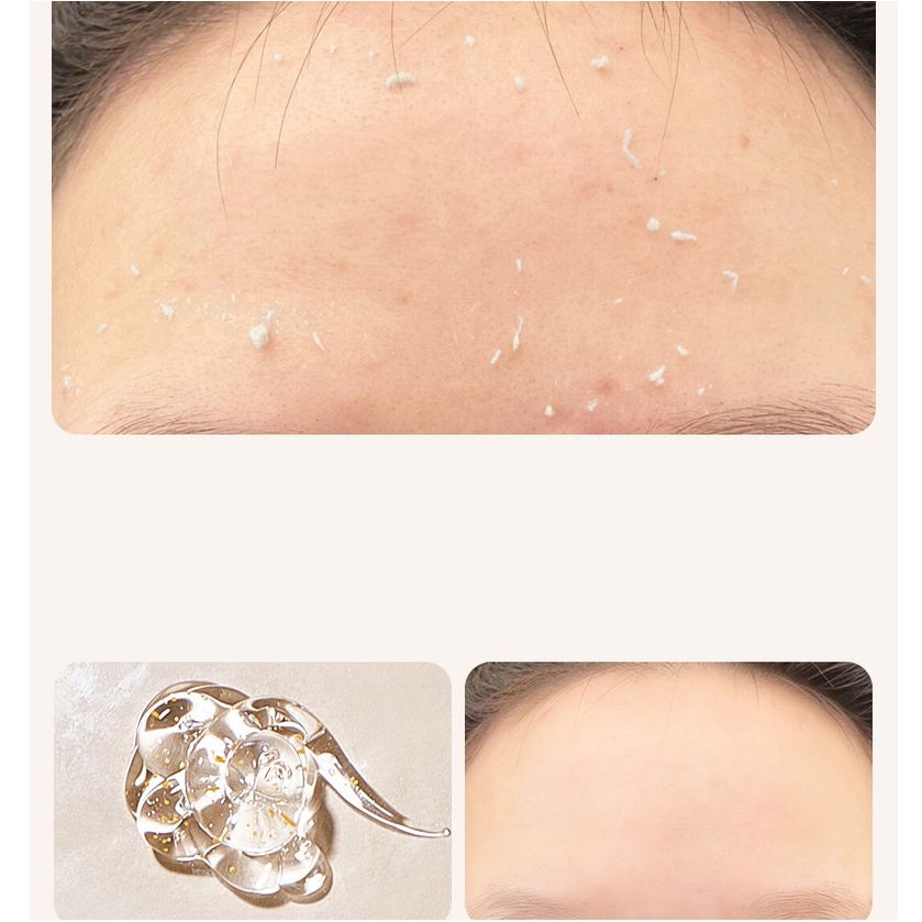 Tẩy Tế Bào Chết Face Body Hữu Cơ HEYXI Cho Mọi Loại Da Giúp Dưỡng Trắng Da Toàn Thân, Giảm Mụn Mờ Thâm