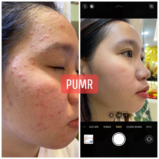 Cốt nhân sâm và kem face tối pumr