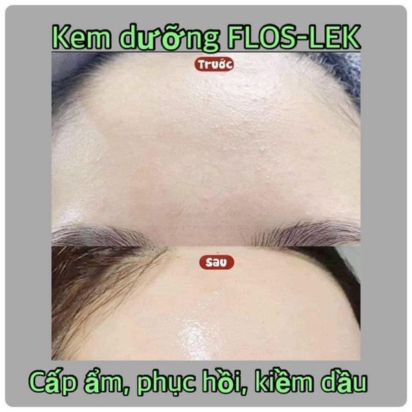 Kem Floslek Kiểm Soát Dầu Và Điều Tiết Nhờn 50ml