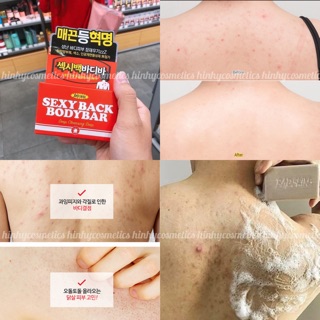 XÀ PHÒNG CẢI THIỆN MỤN LƯNG BAD SKIN