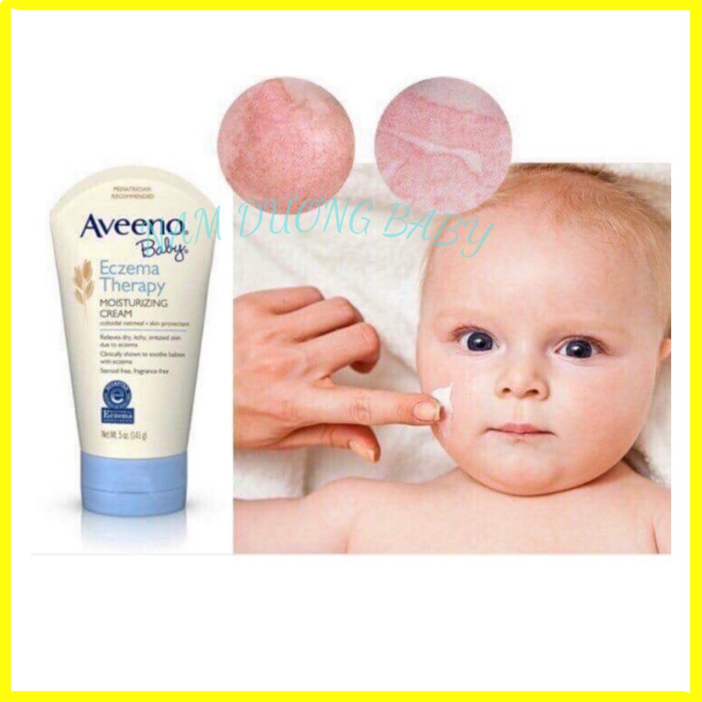 Kem bôi chàm cho bé Aveeno Baby lọ 160g