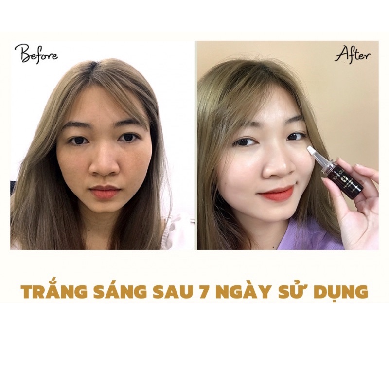 Hộp lẻ Tinh Chất Tế Bào Gốc Tái Tạo Da Yobecell | BigBuy360 - bigbuy360.vn