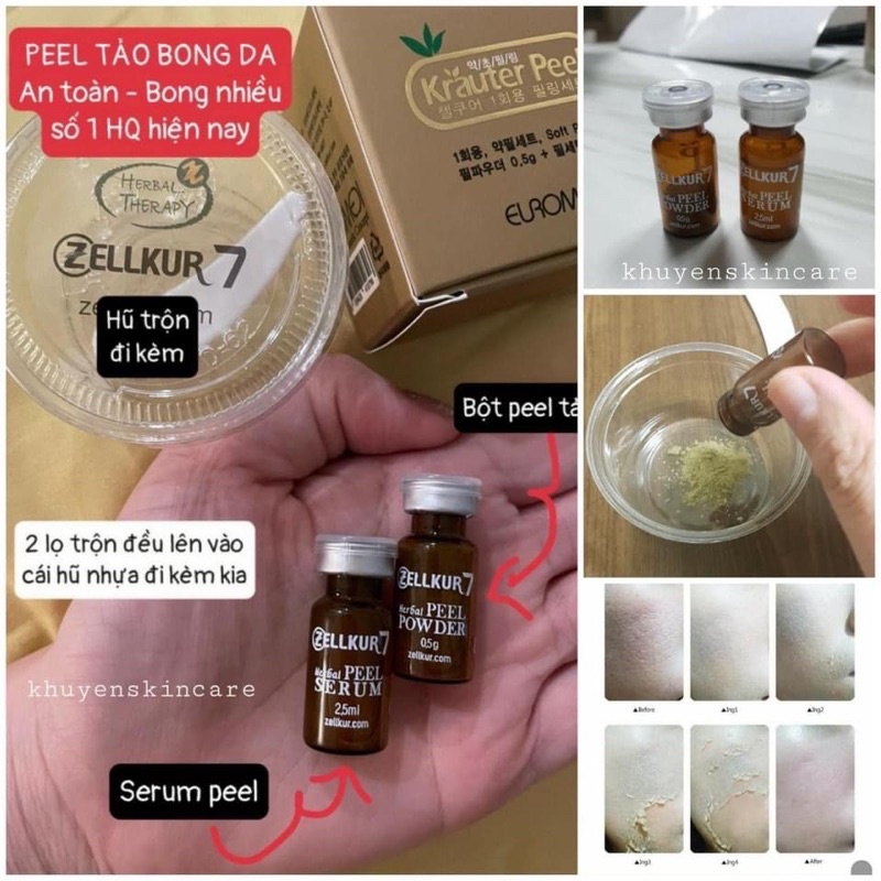 Peel Thảo Mộc Zellkur Krauter Peel