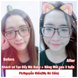 Tinh chất đầy má baby Miracle