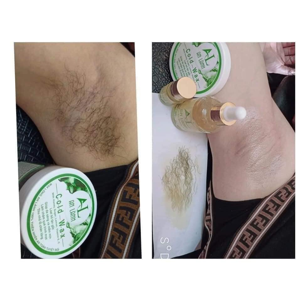 Combo Wax Lông An Lành (Gồm Hũ Wax + Mỡ Trăn + Quà) - 100% Thiên Nhiên