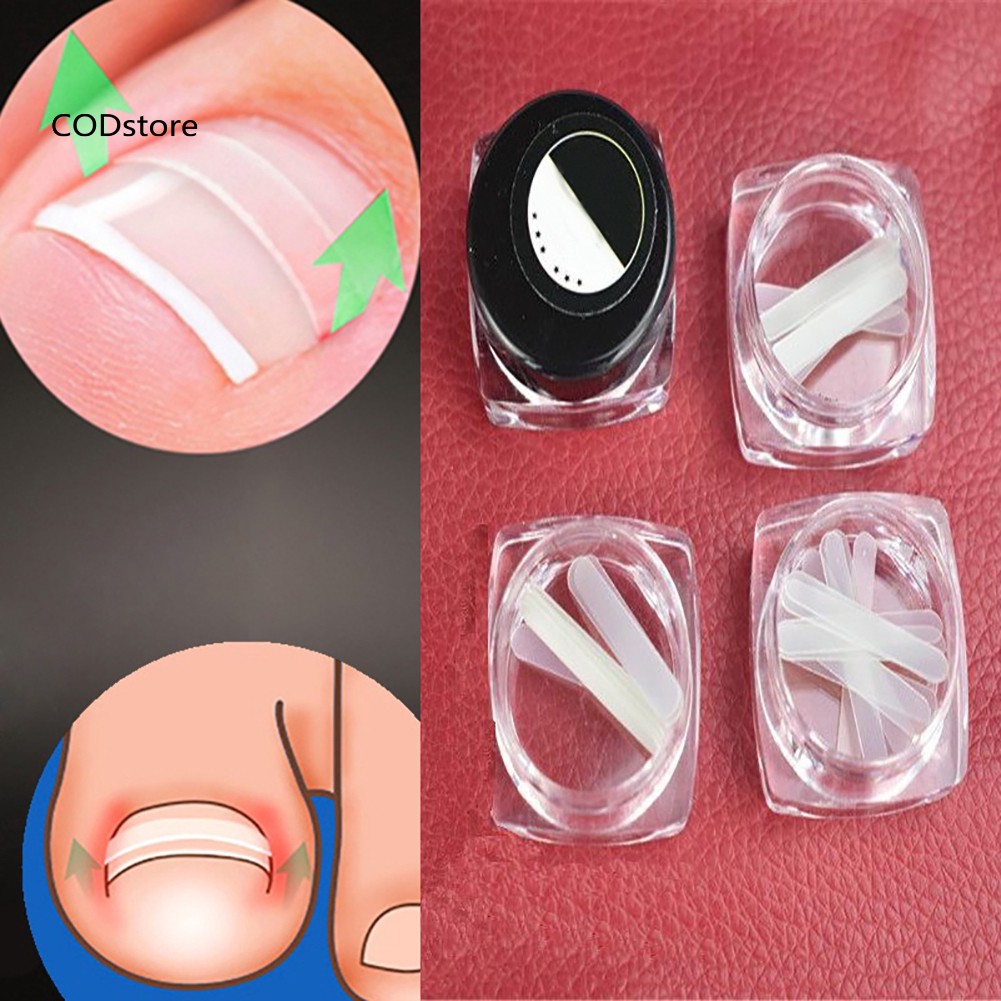 (hàng Mới Về) Set 10 Miếng Dán Điều Chỉnh Móng Chân Mọc Ngược Tiện Dụng | BigBuy360 - bigbuy360.vn