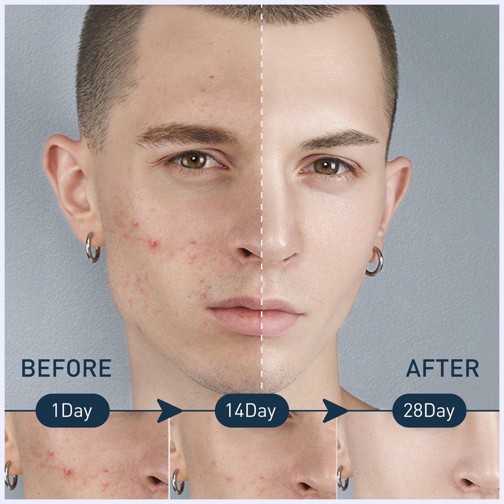 Sữa Rửa Mặt Tạo Bọt Cân Bằng Sâu Cho Nam Giới