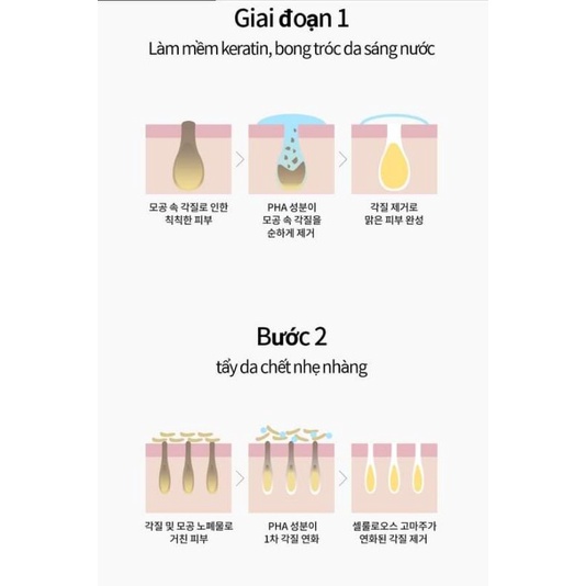 Gel tẩy da chết COSRX LOW PH GOOD NIGHT SOFT PEELING GEL