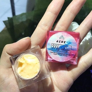 Kem Mụn Acne Mỹ Lyn ( hủ 5g và 10gr ) kèm quà