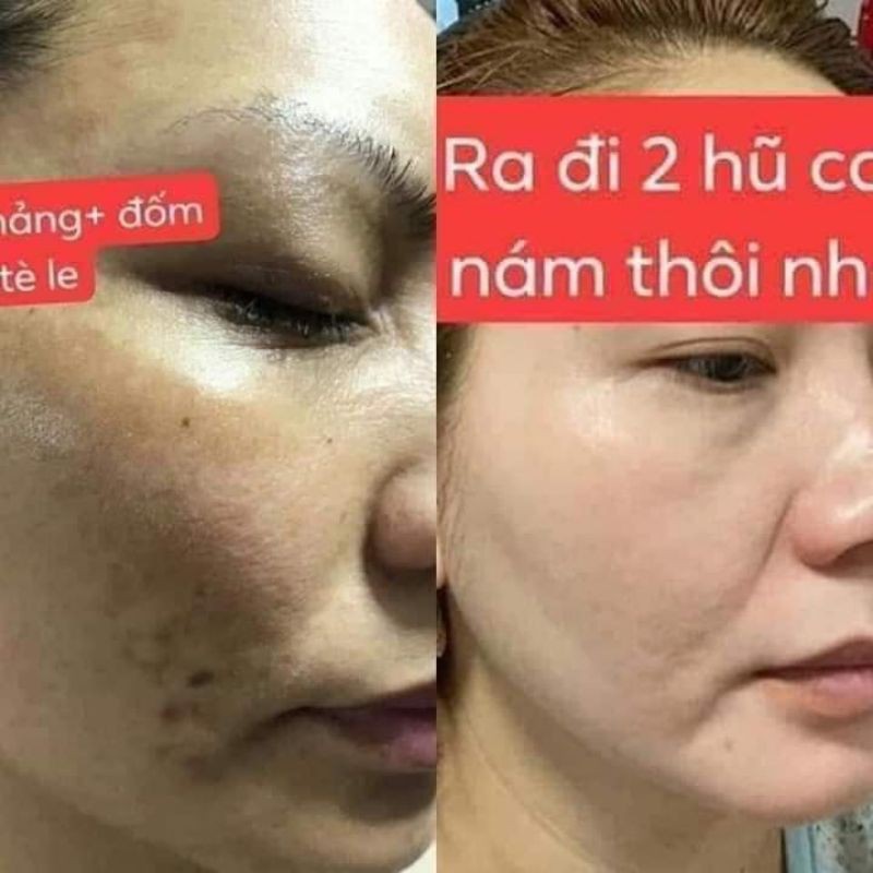 Dr.sen Cao Nám Sen Spa