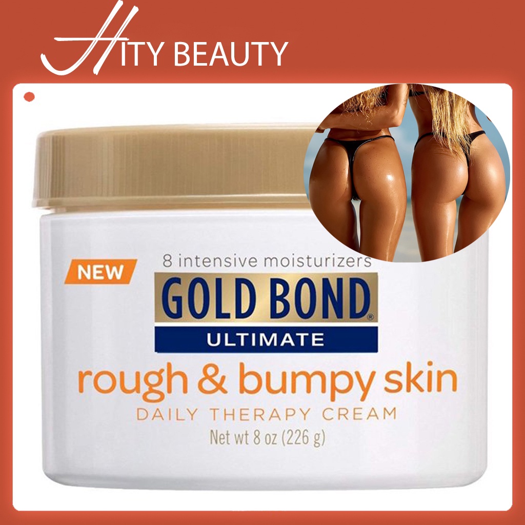 Kem dưỡng da Gold Bond Ultimate Rough & Bumpy Skin Cream 226G - Hity Beauty