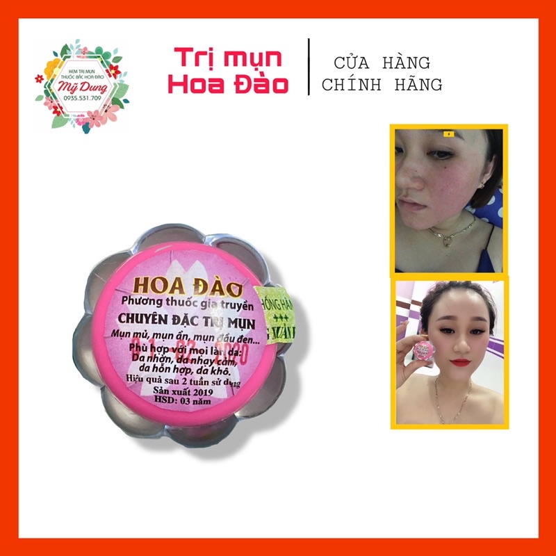 [FREESHIP] [CHÍNH HÃNG] Kem Mụn Thảo Dược Hoa Đào 2 weeks