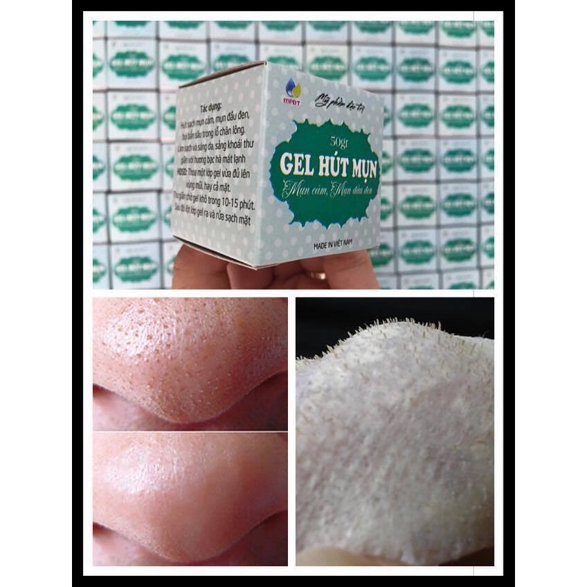 gel hút mụn bạc hà