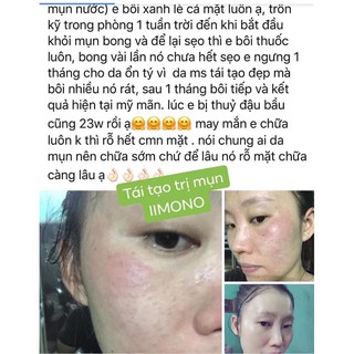 Combo 3 hộp tinh chất mụn IIMONO 6ml