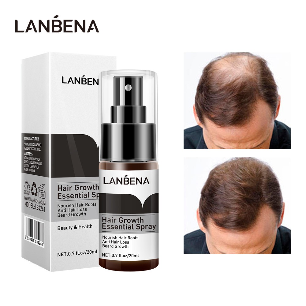 Xịt nhanh mọc tóc LANBENA giúp ngăn ngừa hói đầu chống rụng | BigBuy360 - bigbuy360.vn