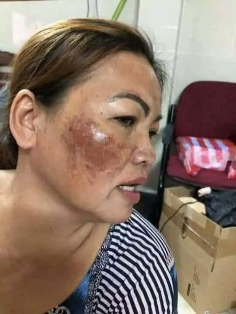 COMBO 10 HỘP CAO CẤP CLOBETAMIL G