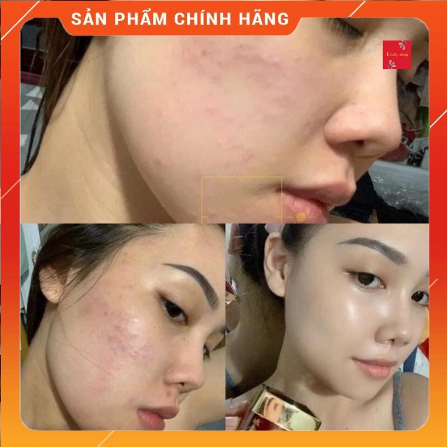 Cao mụn sâm đỏ 36 vị Meea Oranic 15g