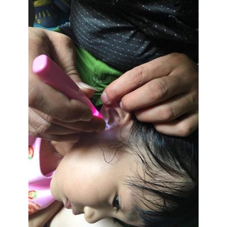 Dụng cụ lấy ráy tai có đèn