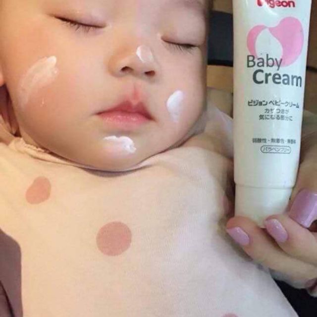 KEM NẺ PIGEON BABY CREAM