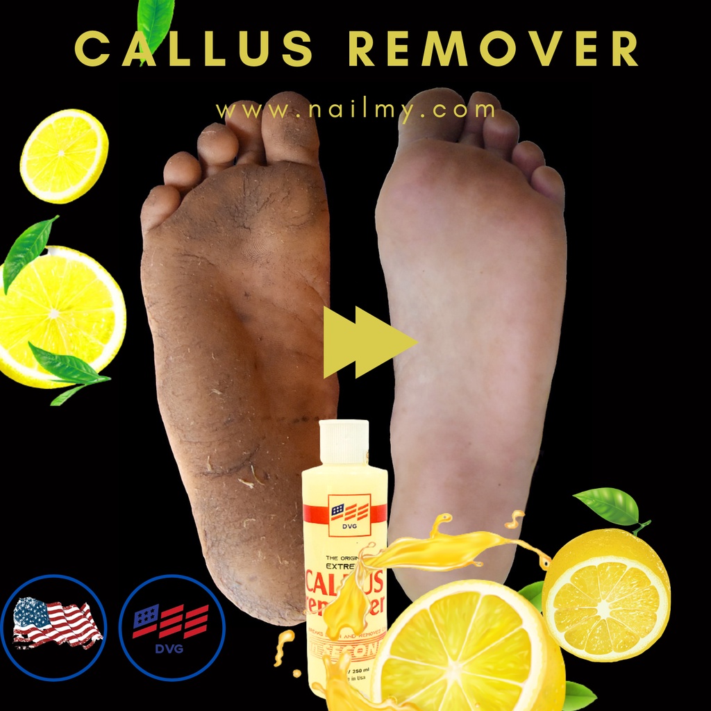 Gel ủ chà gót chân DVG CALLUS REMOVER 250 ml