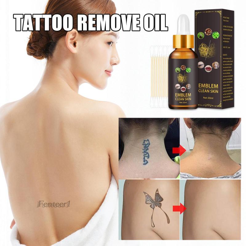 Dung Dịch Loại Bỏ Hình Xăm Vĩnh Viễn An Toàn Fenteer1 30ml