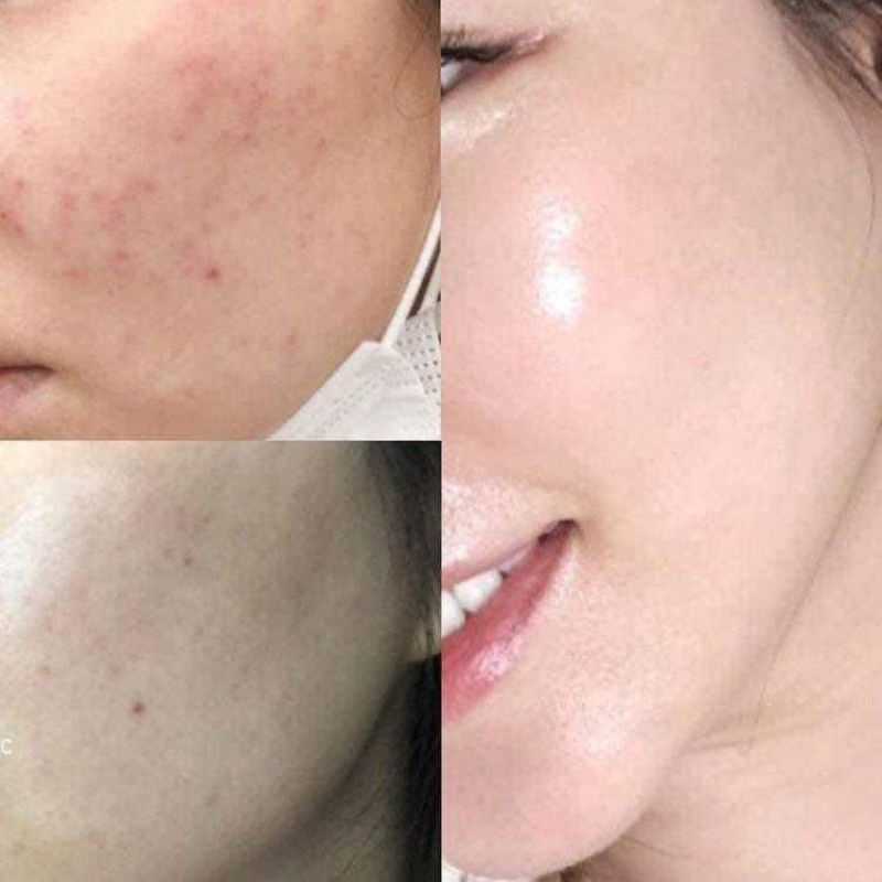 Mặt nạ tảo Volayon Hàn Quốc bột mặt nạ tảo biển cao cấp