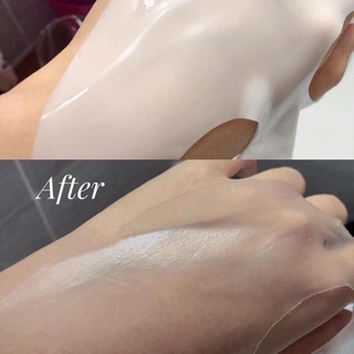 Mặt nạ Derm all Matrix