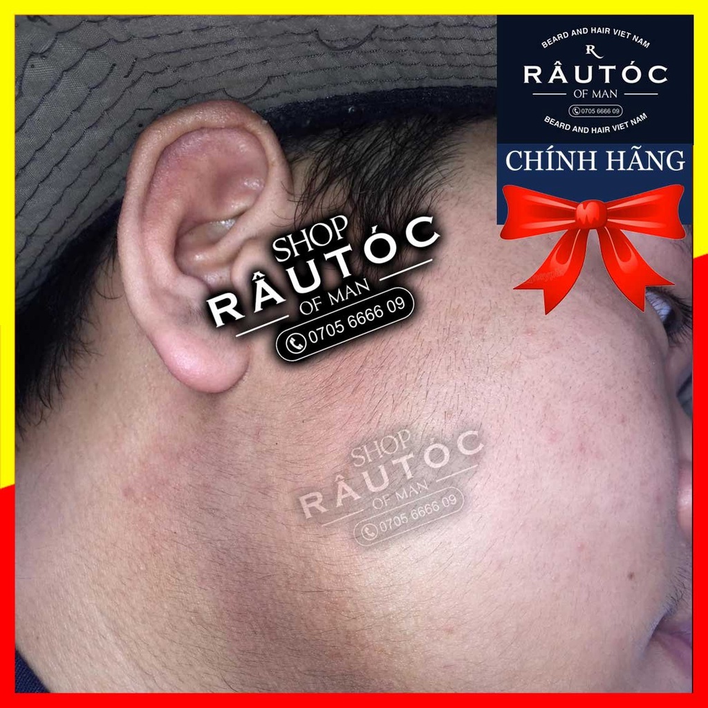 Minoxidil 5% dạng lỏng chính hãng Mỹ tặng 1 ống LCLT
