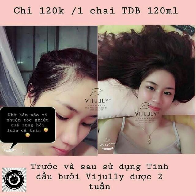 [Tặng Cột Tóc] Tinh Dầu Bưởi Xịt Bưởi Ngăn Ngừa Rụng Tóc Mọc Tóc | BigBuy360 - bigbuy360.vn