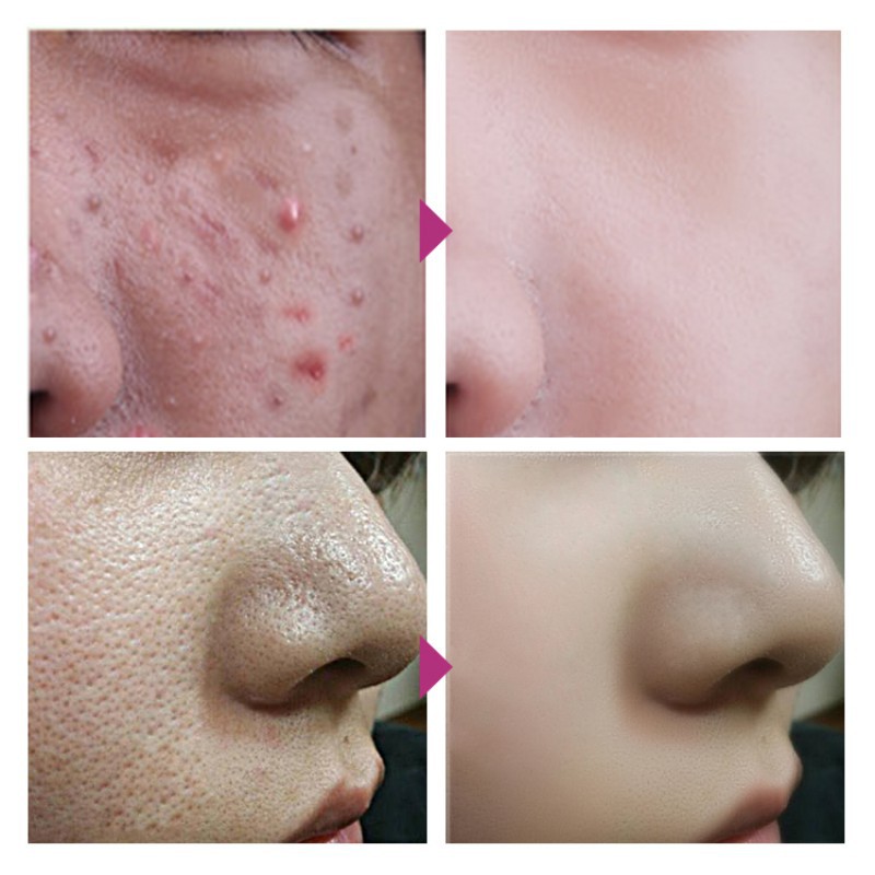 [Hàng mới về] Kem ô liu dưỡng ẩm xóa nếp nhăn làm săn chắc mềm mịn da